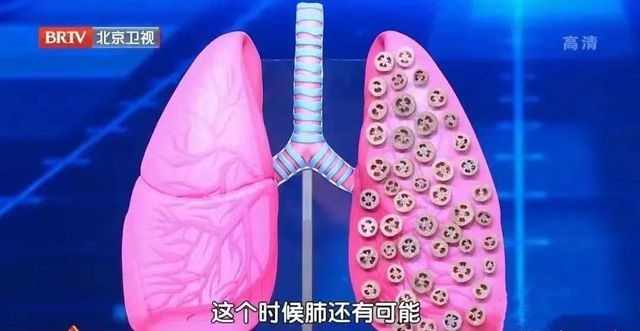 2种水果堪称天然“养骨王”常吃不怕骨头松！不知道的亏大了(图4)