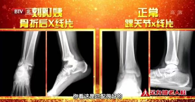 2种水果堪称天然“养骨王”常吃不怕骨头松！不知道的亏大了(图2)