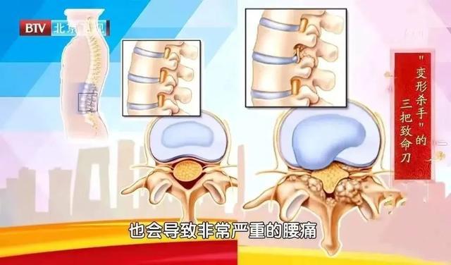 2种水果堪称天然“养骨王”常吃不怕骨头松！不知道的亏大了(图5)