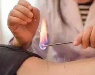 kaiyun开云网站【名医名科】带状疱疹疼痛难忍？您可以相信针灸治疗！(图5)