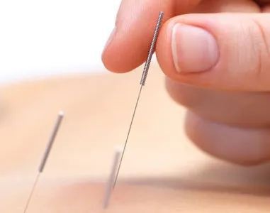 kaiyun开云网站【名医名科】带状疱疹疼痛难忍？您可以相信针灸治疗！(图4)